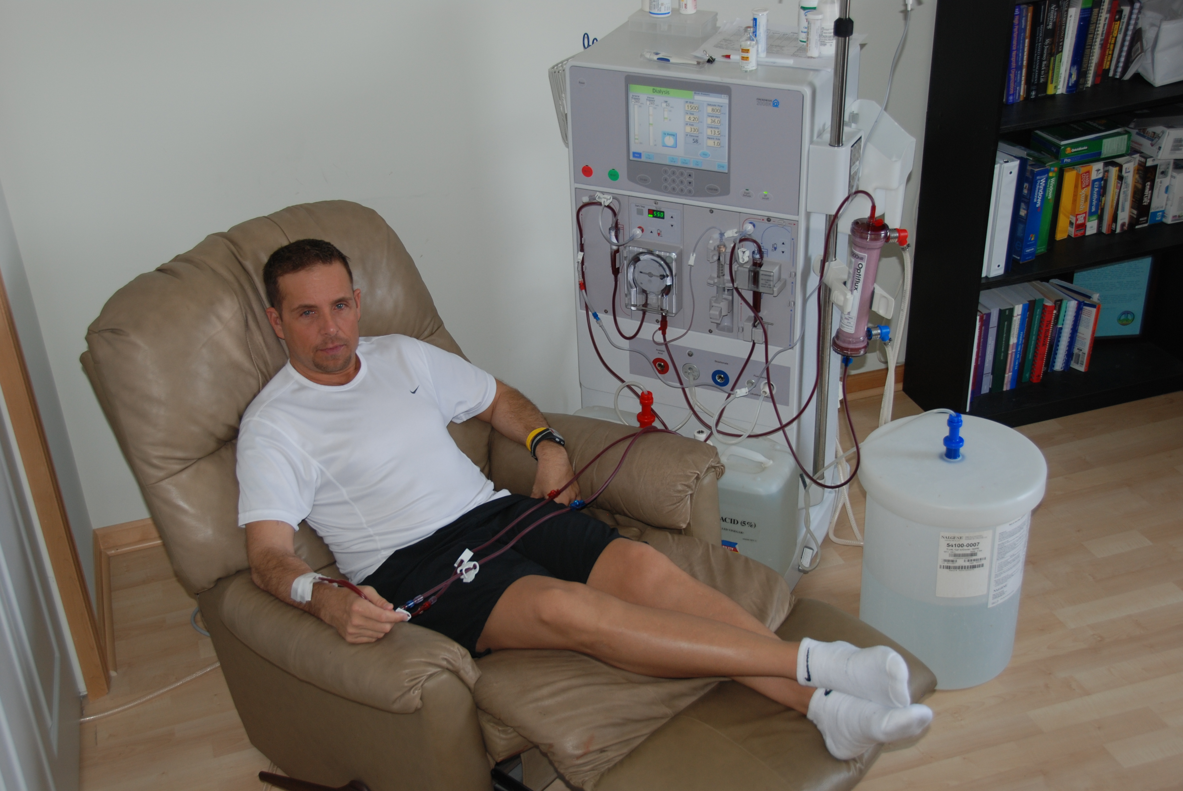 is-it-really-possible-to-get-off-kidney-dialysis-10-symptoms-of